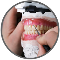 dental prosthetics Bristol
